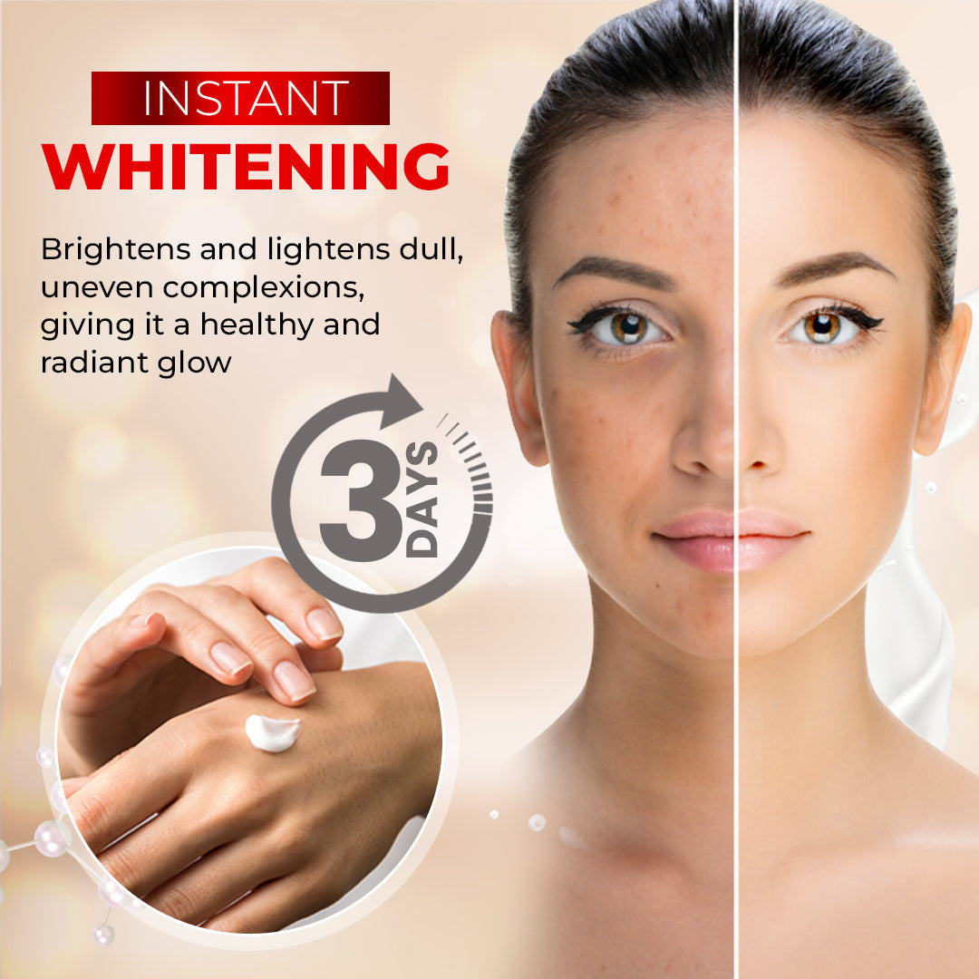 SkinFresh™ - 3 Day Kojic Acid Whitening Cream | 1+1 GRATIS!